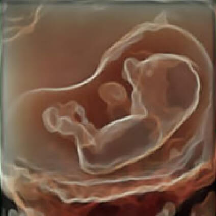胎児の写真